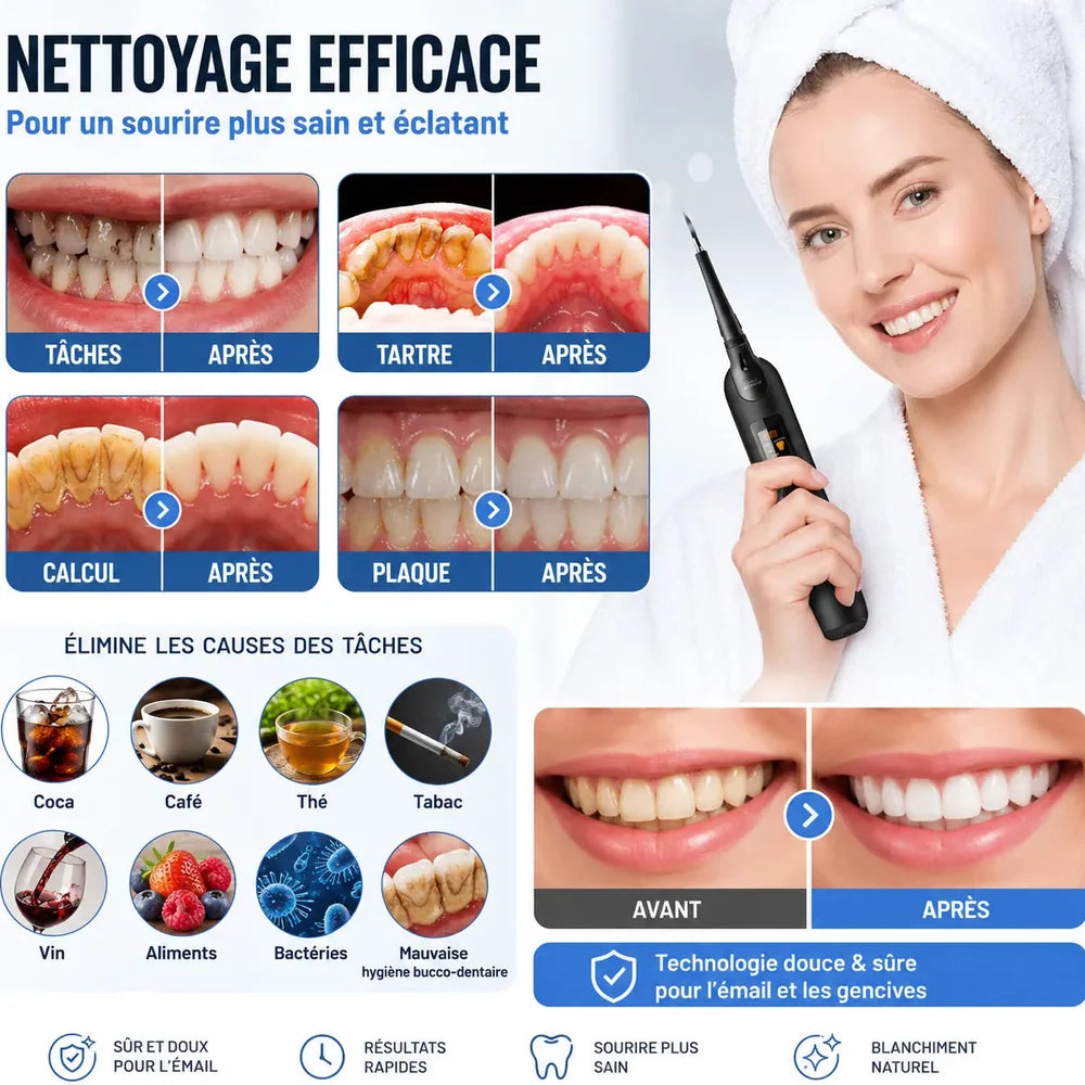Détartreur Dentaire Électrique à Ultrasons avec 5 Intensités Jolinova™